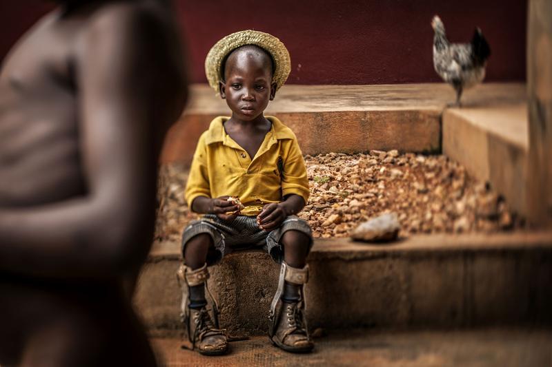 Unicef-Foto des Jahres zeigt behinderten Jungen aus Togo